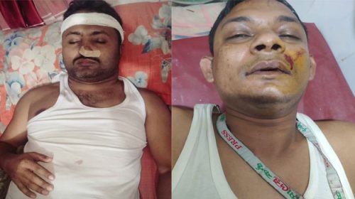 আহত সাংবাদিক অমর ও রাজু