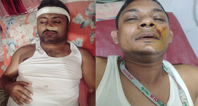আহত সাংবাদিক অমর ও রাজু